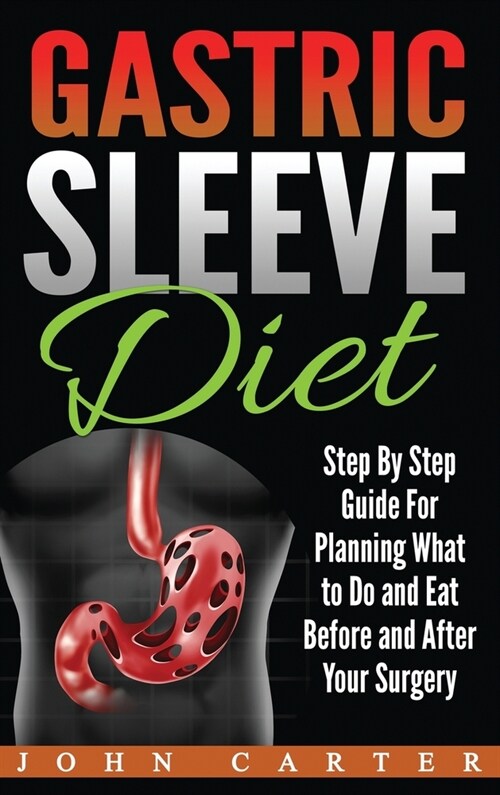 Gastric Sleeve Diet: Step By Step Guide For Planning What to Do and Eat Before and After Your Surgery (Hardcover)