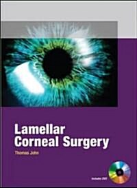 Lamellar Corneal Surgery (Hardcover)