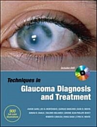 Glaucoma (Hardcover, DVD-ROM, 1st)