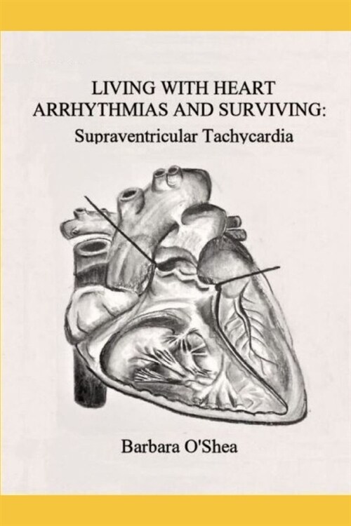 Living with Heart Arrhythmias and Surviving: Supraventricular Tachycardia (Paperback)