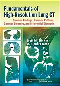 [중고] Fundamentals of High-Resolution Lung Ct: Common Findings, Common Patterns, Common Diseases, and Differential Diagnosis: Common Findings, Common P (Paperback)