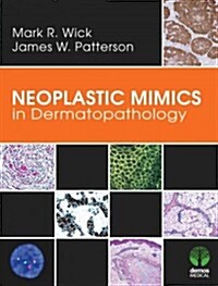 Neoplastic Mimics in Dermatopathology (Hardcover, 1st)
