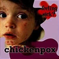 Chickenpox (Library Binding)