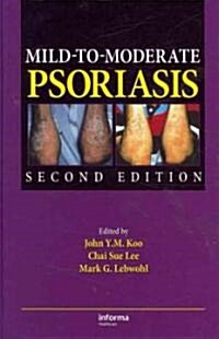 Mild-to-Moderate Psoriasis (Hardcover, 2nd)