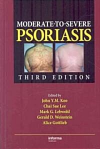 Moderate-to-Severe Psoriasis (Hardcover, 3rd)