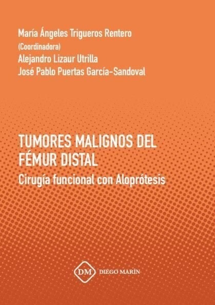 TRTAMIENTO DE LA ARTROSIS DE RODILLA CON INFILTRACION ARTICU (Paperback)