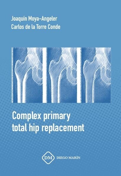 COMPLEX PRIMARY TOTAL HIP REPLACEMENT (Paperback)