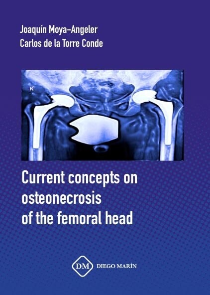 CURRENT CONCEPTS ON OSTEONECROSIS OF THE FEMORAL HEAD (Paperback)