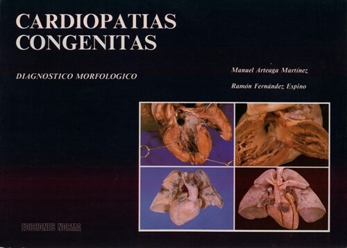 CARDIOPATIAS CONGENITAS (Book)