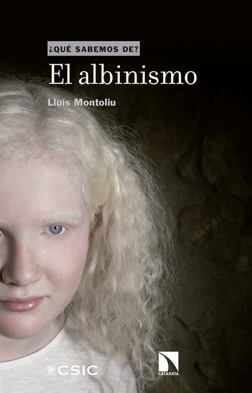 ALBINISMO,EL (Paperback)