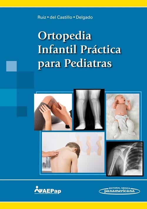 ORTOPEDIA INFANTIL PRACTICA PARA PEDIATRAS (Paperback)