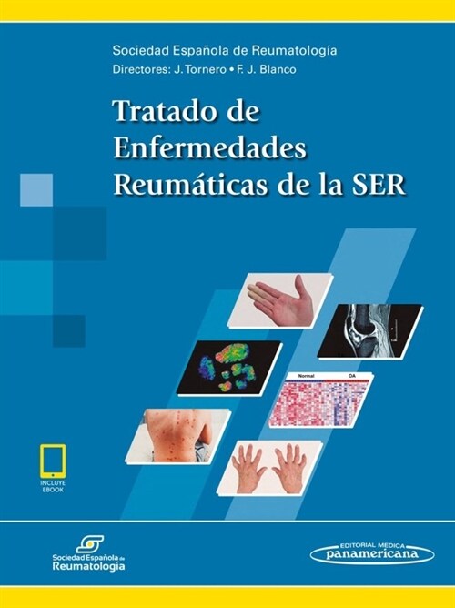 TRATADO DE ENFERMEDADES REUMATICAS DE LA SER (INCLUYE EBOOK) (Paperback)