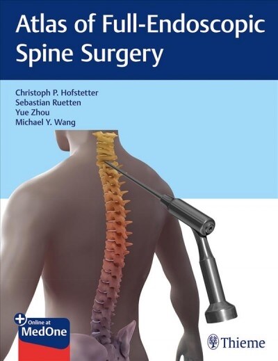 Atlas of Full-endoscopic Spine Surgery (Paperback)