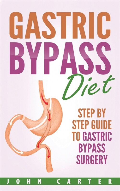 Gastric Bypass Diet: Step By Step Guide to Gastric Bypass Surgery (Hardcover)