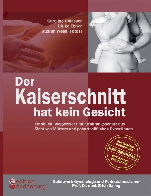 Der Kaiserschnitt hat kein Gesicht - Fotobuch, Wegweiser und Erfahrungsschatz aus Sicht von M?tern und geburtshilflichen ExpertInnen (Paperback)