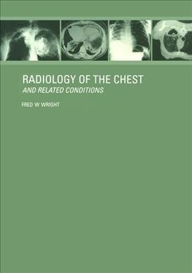 Radiology of the Chest and Related Conditions (Hardcover)