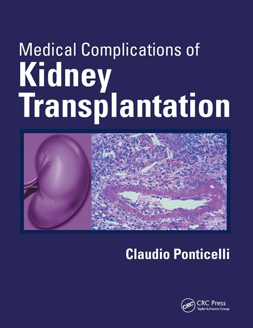 Medical Complications of Kidney Transplantation (Paperback)