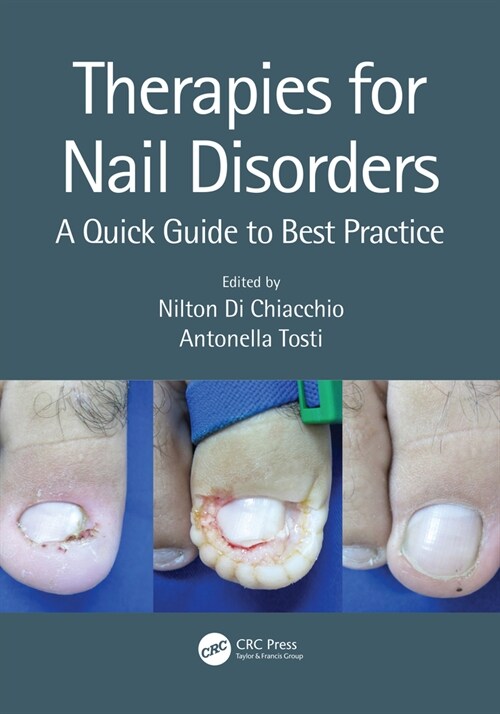 Therapies for Nail Disorders : A Quick Guide to Best Practice (Hardcover)