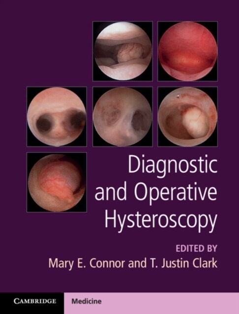 Diagnostic and Operative Hysteroscopy (Hardcover)
