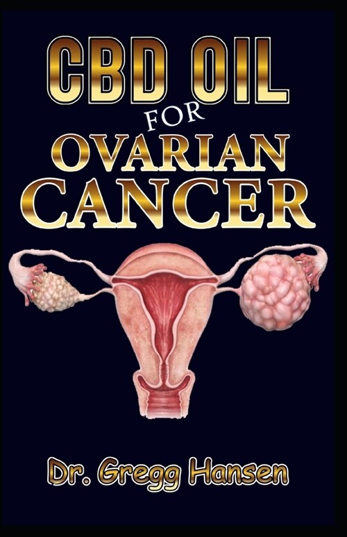 CBD Oil for Ovarian Cancer: Your Therapeutic Guide to the Treatment of Ovary and Uterus Related Tumor (Number One Solution) (Paperback)