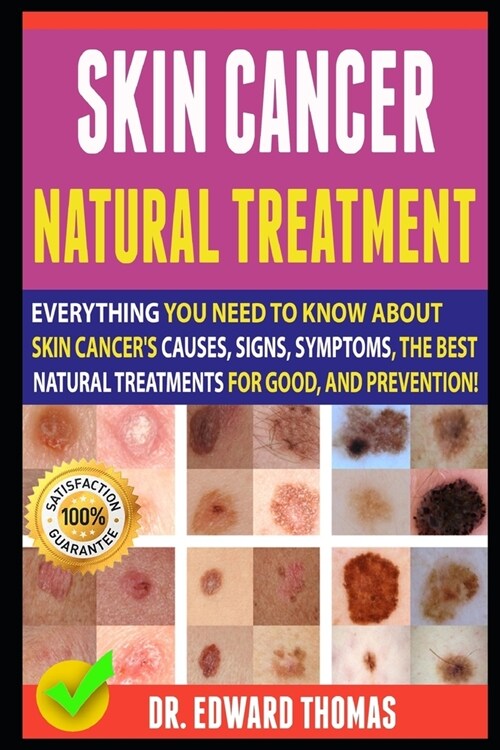 Skin Cancer Natural Treatment: Everything You Need To Know About Skin Cancers Causes, Signs, Symptoms, The Best Natural Treatments For Good, And Pre (Paperback)