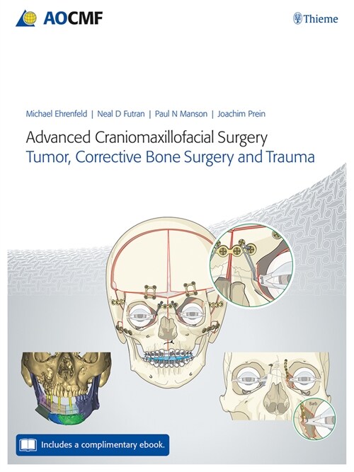 Advanced Craniomaxillofacial Surgery: Tumor, Corrective Bone Surgery, and Trauma (Hardcover)