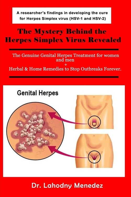 The Mystery Behind the Herpes Simplex Virus Revealed: The Genuine Genital Herpes Treatment for women and men + Herbal & Home Remedies to Stop Outbreak (Paperback)