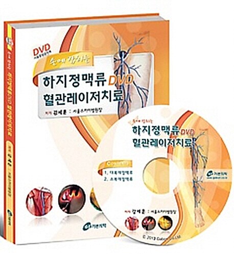 손에 잡히는 하지정맥류DVD 혈관레이저치료 (책 + CD 1장)