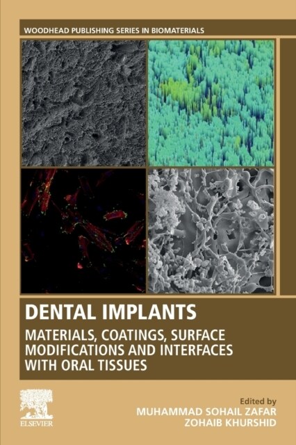 Dental Implants: Materials, Coatings, Surface Modifications and Interfaces with Oral Tissues (Paperback)