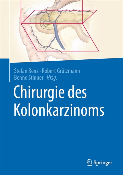 Chirurgie des Kolonkarzinoms (Hardcover)