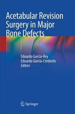 Acetabular Revision Surgery in Major Bone Defects (Paperback)