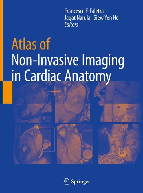 Atlas of Non-Invasive Imaging in Cardiac Anatomy (Hardcover)