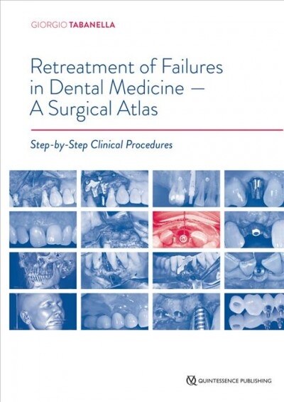 Retreatment of Failures in Dental Medicine -- A Surgical Atlas: Step-By-Step Clinical Procedures (Hardcover)