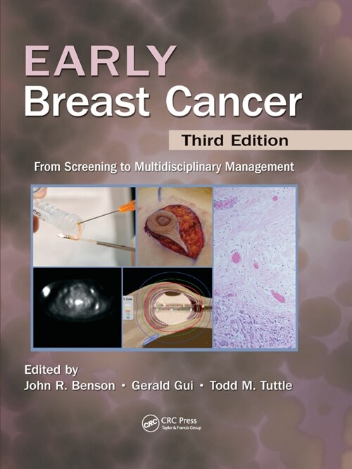Early Breast Cancer : From Screening to Multidisciplinary Management, Third Edition (Paperback, 3 ed)