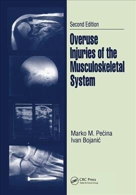 Overuse Injuries of the Musculoskeletal System (Paperback, 2 ed)