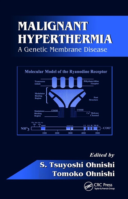 Malignant Hyperthermia : A Genetic Membrane Disease (Paperback)