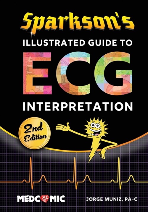 Sparksons Illustrated Guide to ECG Interpretation, 2nd Edition (Paperback, 2)
