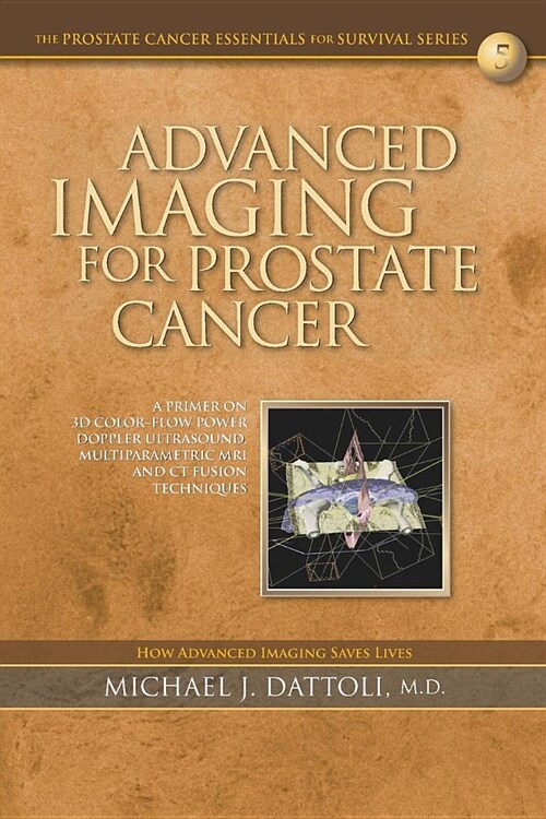 Advanced Imaging for Prostate Cancer: A Primer on 3D Color-Flow Power Doppler Ultrasound, Multiparametric MRI and CT Fusion Techniques (Paperback)