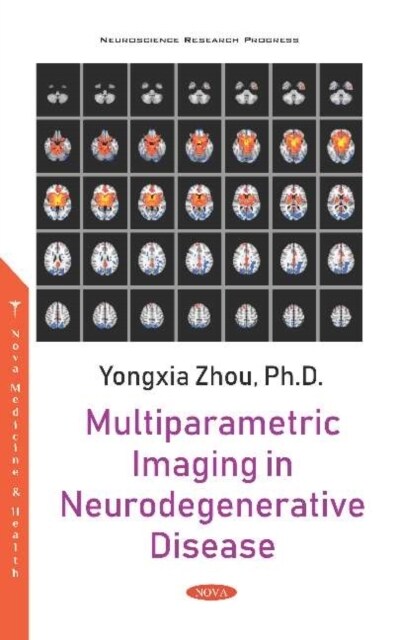 Multiparametric Imaging in Neurodegenerative Disease (Paperback)