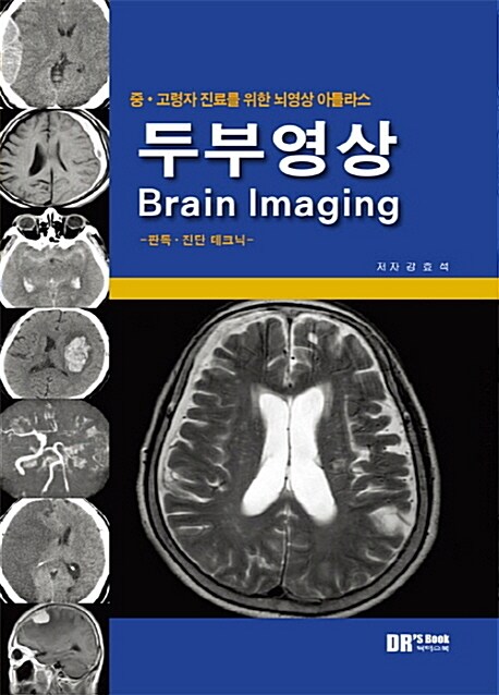 뇌영상 아틀라스 두부영상 Brain Imaging