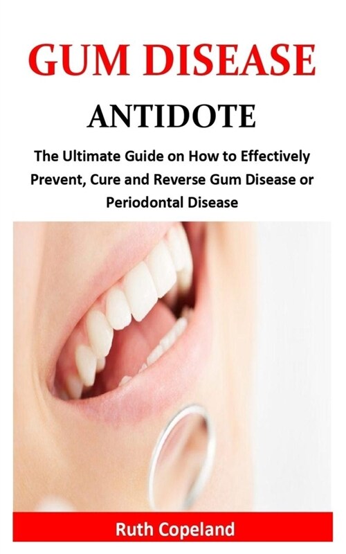 Gum Disease Antidote: The Ultimate Guide on How to Effectively Prevent, Cure and Reverse Gum Disease or Periodontal Disease (Paperback)