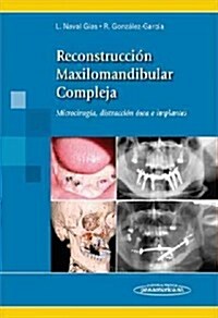 Reconstrucci? maxilomandibular compleja / Reconstruction maxillomandibular complex (Hardcover)