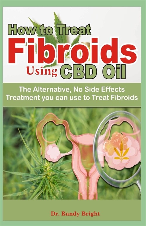 How to Treat Fibriods Using CBD oil: The Alternative No Side Effects treatment you can use to Treat Fibroids (Paperback)