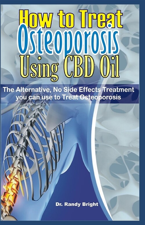 How to Treat Osteoporosis Using CBD Oil: The Alternative No Side Effects Treatment you can use to Treat Osteoporosis (Paperback)