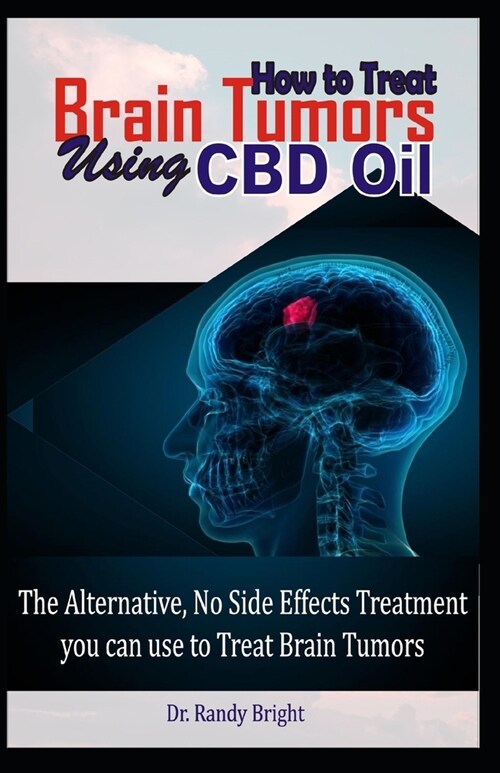How to Treat Brain Tumors Using CBD Oil: The Alternative No Side Effects Treatment you can use to Treat Brain Tumors (Paperback)