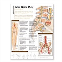 Understanding Low Back Pain Anatomical Chart (Other)