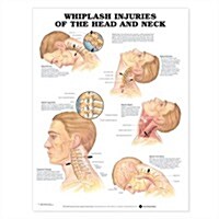 Whiplash Injuries of the Head and Neck Anatomical Chart (Hardcover)