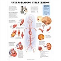 Understanding Hypertension Anatomical Chart (Hardcover)