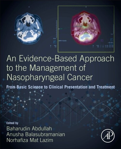 An Evidence-Based Approach to the Management of Nasopharyngeal Cancer: From Basic Science to Clinical Presentation and Treatment (Paperback)