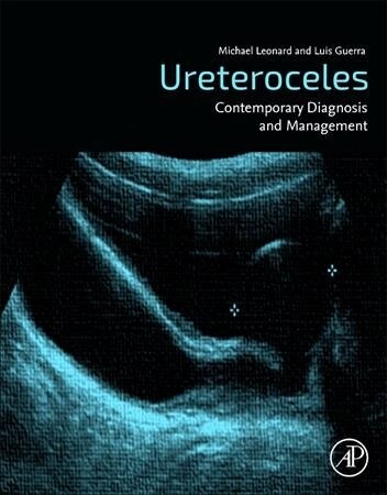 Ureteroceles: Contemporary Diagnosis and Management (Paperback)